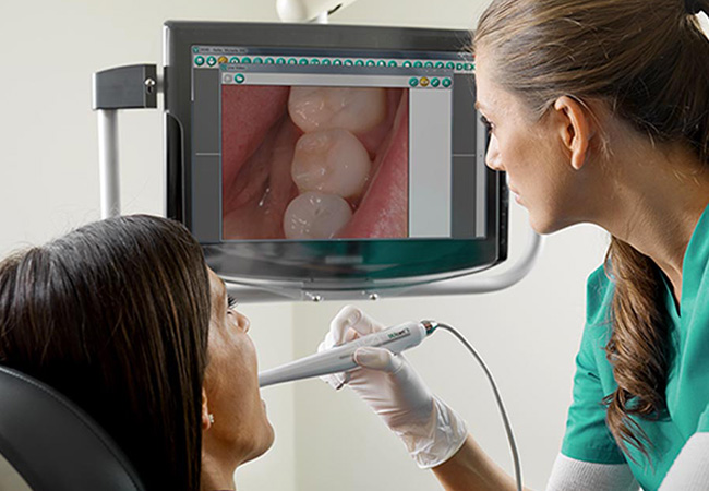 videocamera intraorale