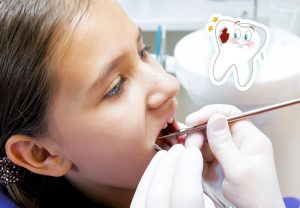 Dentino cariato