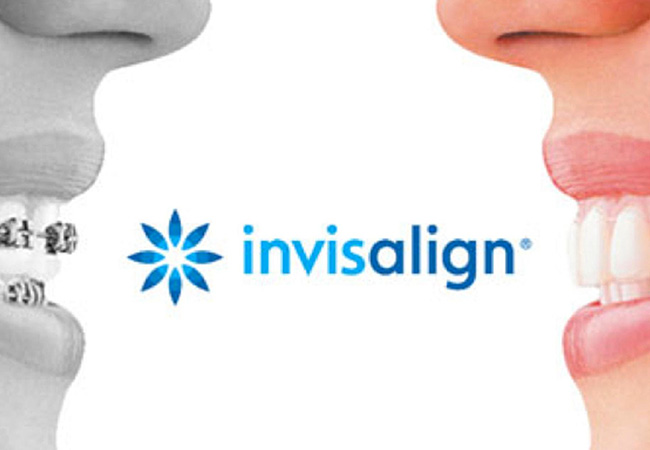 Terapia Ortodontica Invisalign